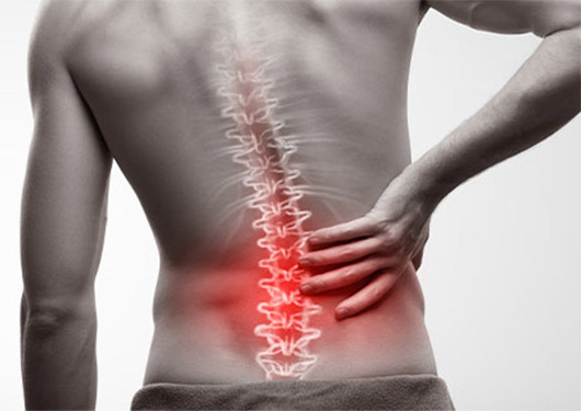 ヘルニアイメージ