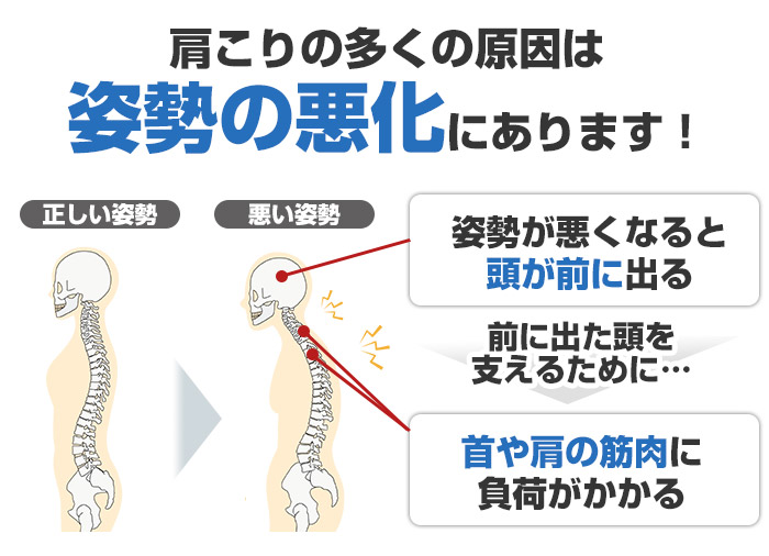 肩こりの多くの原因
