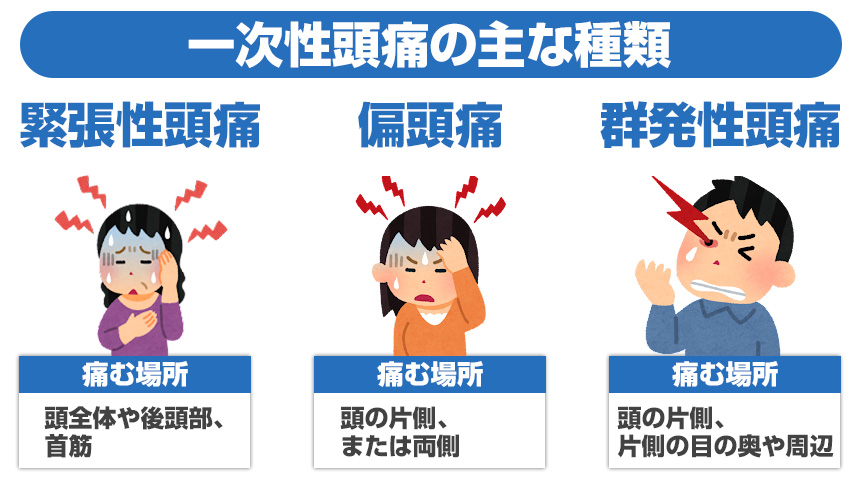 頭痛の主な種類